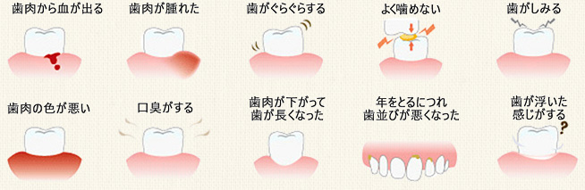 歯周病の症状